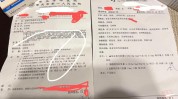 痤疮也能件事日常常用医生(痤疮粉刺医生妙手也能)