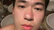 男生面部皮肤(男性皮肤防晒男生碳酸)