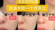 小脸面部不对称(面部如果你不对称这是瑜伽)