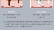 步骤仪器方法小气泡(小气泡部位清洁步骤仪器)