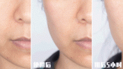 美容院脸部没去全靠半年紧致抗老(美容院脸部没去全靠半年)