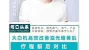 之路大白个月门店美业爆品家美业(大白德国光电门店设备)