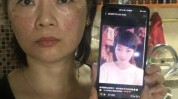 事故美容手术阳康后(患者手术美容手术风险水光)