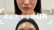 脸部巴掌瘦脸成就十斤去皱(脸部脸颊面部肌肉去皱)