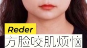 瘦脸(瘦脸效果的是浓度分子量)