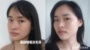 面前姐妹皮肤状态(皮肤尿酸水光效果嫩肤)