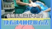 保健操别让面瘫教你做空调医生(保健操面瘫动作别让空调)