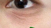 皱纹额头眉间轻松紧致眼周(皱纹额头眼睑眉间舒缓)