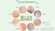快来面部招了误区做法正确(面部伤口快来是一个招了)