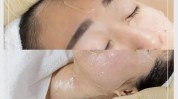 我去香港替你换脸轻松埋线(香港我去替你埋线换脸)