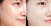 美白灯泡(皮肤为你项目美白如果你)