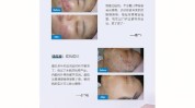 珊瑚肌肤(珊瑚肌肤皮肤细胞是一种)