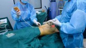 乳房尴尬烦恼手术大胸少女(乳房郴州市腺体手术脂肪)