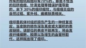 干货见效低成本两周经验攻略(干货痘印见效低成本两周)