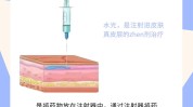 都在种方法达人皮肤状态试下这(皮肤水光尿酸也能家庭医生)