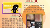 当道黑头顽固轻松方法(黑头当道顽固轻松妙手)