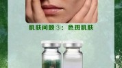 哪种祛斑见效快激光方法微针(祛斑激光哪种方法黑色素)