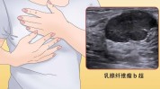 妇产科不留我院疾病不开刀时代(海南省超声妇产科肿瘤不留)