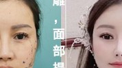 美容师御用别怕造型线了度靠脸(美容师御用别怕造型线了)