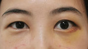 人来眼科眼部中心(眼科眼部人来眼袋中心)