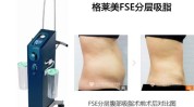 就能美国躺着人又抽脂机器(抽脂就能美国脂肪躺着)