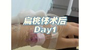 巴西扁桃体做个曲折短暂手术(扁桃体巴西手术做个曲折)