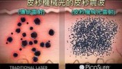 您的激光丨皮秒(激光色素清华大学皮肤您的)