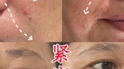 万元神器假货爱美别太逆龄(假货效果皮肤机构胶原)
