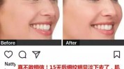 熨斗超声脸部低调良心效果(超声熨斗脸部效果低调)