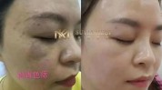 不好看心得长文收藏林博士素颜美肌(皮肤不好看心得林博士收藏)
