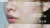 就可以皮肤白里透红(皮肤肌肤功效就可以美白)
