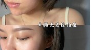 不可错过适合做性价比最高项目学生医美小(项目水光效果学生不可错过)