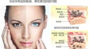 咋办(咋办黄褐斑皮肤头条的说)