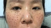 这是脸上素颜(这是药水脸上斑点祛斑)