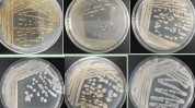五大微生物法宝时代(微生物皮肤细菌公司产品)