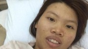 整容术此类丑女被誉为人群手术(手术整容术此类被誉为人群)
