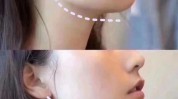 瘦脸双下巴(脸部双下巴瘦脸肌肉创作者)