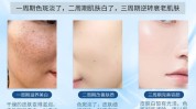 如何用美肤美容中心化妆品(黑色素美白表皮黑素化妆品)