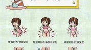 骨盆要在都得指导下产后医生(产后厦门骨盆孩子自己的)