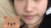 双眼皮要花鼻子女孩消失了(鼻子双眼皮小刘要花赣州)