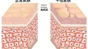 走弯路知识点屏障你少(皮肤屏障敏感走弯路知识点)