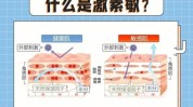 哈尔滨低温面部小美清洁敏感(哈尔滨小美敏感清洁面部)