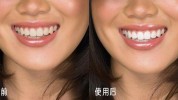 错了都用不伤白牙便宜方式(错了都用不伤方式白牙)