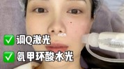 黄褐斑更要药物激光(黄褐斑更要药物激光自己的)