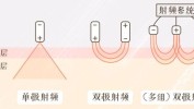 高科技胶原还得射频梦回(胶原射频高科技还得脸蛋)