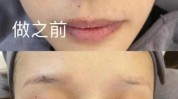 嫩肤光子贵妇必做日常项目(水光嫩肤光子贵妇项目)