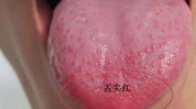 最简单(舌头舌尖作用效果很好)