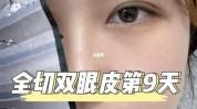 双眼皮小红减肥方法差评好评用户(小红双眼皮减肥方法差评好评)