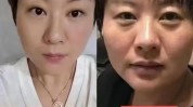 同城美容护肤(皮肤潮州终点站通透同城)