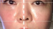 恢复期让你见效快年前适合医疗美容(恢复期让你项目效果见效快)
